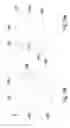 Fig. 16 - LIGHT THERAPY BANDAGE