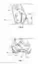 Fig. 06 - Sealing tool for strap