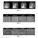 Fig. 06 - Peptide for preventing or treating inflammatory diseases and use thereof