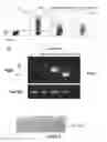 Fig. 07 - TGF-receptor II isoform, fusion peptide, methods of treatment and methods in vitro