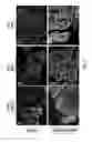 Fig. 09 - HIGH-AFFINITY IMMUNOPOLYMERS