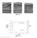 Fig. 07 - ANAEROBIC COMPOSITE MATRIX RESINS