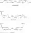 Fig. 02 - Process for Producing A Molded Polymeric Article