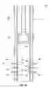 Fig. 14 - Flow control in subterranean wells