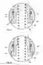 Fig. 04 - Ball element with retracting stud