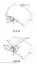 Fig. 06 - Shield attachment method and device
