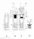 Fig. 01 - Device and method for monitoring the temperature of a cryogenically preserved biological sample