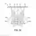 Fig. 05 - Ultrasound transducer arrays with variable patch geometries