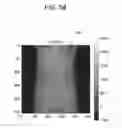 Fig. 06 - Medical image processing apparatus, medical image processing method and medical image processing system