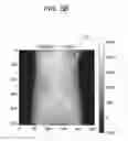 Fig. 07 - Medical image processing apparatus, medical image processing method and medical image processing system