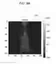 Fig. 34 - Medical image processing apparatus, medical image processing method and medical image processing system