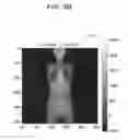 Fig. 35 - Medical image processing apparatus, medical image processing method and medical image processing system
