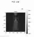 Fig. 41 - Medical image processing apparatus, medical image processing method and medical image processing system