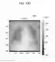 Fig. 43 - Medical image processing apparatus, medical image processing method and medical image processing system