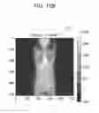 Fig. 49 - Medical image processing apparatus, medical image processing method and medical image processing system