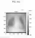 Fig. 50 - Medical image processing apparatus, medical image processing method and medical image processing system