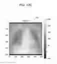 Fig. 64 - Medical image processing apparatus, medical image processing method and medical image processing system