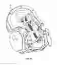 Fig. 17 - Birthing simulation devices, systems, and methods