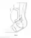 Fig. 23 - Birthing simulation devices, systems, and methods
