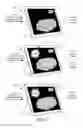 Fig. 02 - Pulse-width modulation based on image gray portion