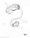 Fig. 02 - Antenna for a hearing assistance device
