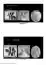 Fig. 09 - Bactericide composition based on a mixture of bacteriophages for the control of black plague in plants or parts thereof, preferably the walnut, caused by Xanthomonas arboricola pv. juglandis; preparation method and application