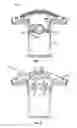 Fig. 05 - Sensor garment