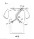 Fig. 15 - Sensor garment