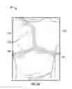 Fig. 27 - Sensor garment
