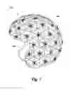 Fig. 02 - Helmet with external flexible cage