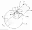 Fig. 01 - Direct visualization catheter and system