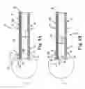 Fig. 06 - Direct visualization catheter and system