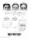 Fig. 03 - OCULAR VERGENCE-ENABLED EYE TRACKING METHODS AND SYSTEMS
