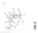 Fig. 07 - Hybrid OCT and surface contour dental imaging