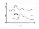 Fig. 07 - METHOD AND DEVICE FOR MEASURING BLOOD PRESSURE