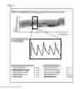 Fig. 09 - Biological information analysis device, biological information analysis system, program, and biological information analysis method