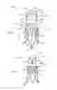Fig. 02 - Heart valve prosthesis and method