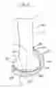Fig. 03 - Arthroplasty devices and related methods