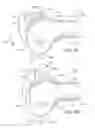 Fig. 07 - Arthroplasty devices and related methods