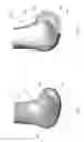 Fig. 02 - Intraoperative dynamic trialing