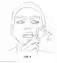 Fig. 08 - Dermatology Tool for Extraction of Sebaceous Material from Pores
