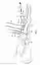 Fig. 02 - Lapidus screw guide assembly and method of insertion