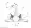 Fig. 02 - Cranial anchoring and positioning system and method