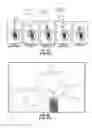 Fig. 03 - Poly axial dental implant system