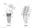 Fig. 09 - Poly axial dental implant system