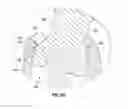 Fig. 13 - Poly axial dental implant system
