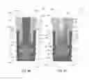 Fig. 09 - Screwless dental implant connection