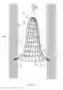 Fig. 07 - Vascular filter system and method of deployment and retrieval of vascular filter