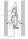 Fig. 18 - Vascular filter system and method of deployment and retrieval of vascular filter