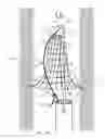 Fig. 19 - Vascular filter system and method of deployment and retrieval of vascular filter